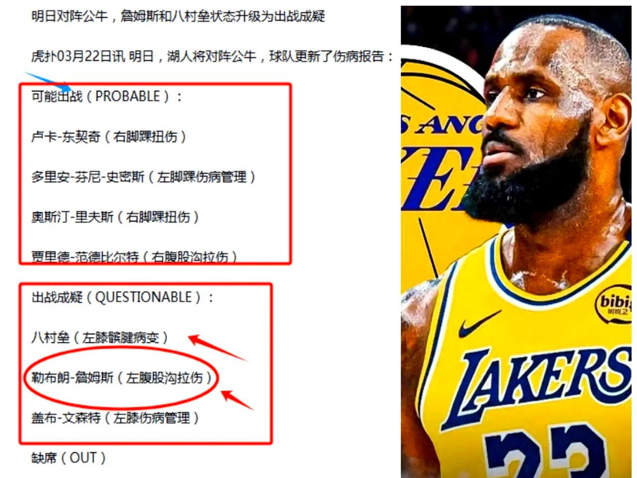 签约完成，告别湖人！紫金军再遭重创，詹姆斯争夺第5冠更添困难的简单介绍